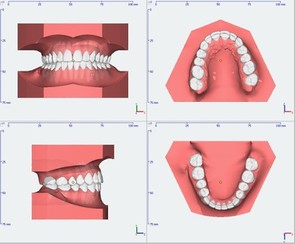 Intraoralscan